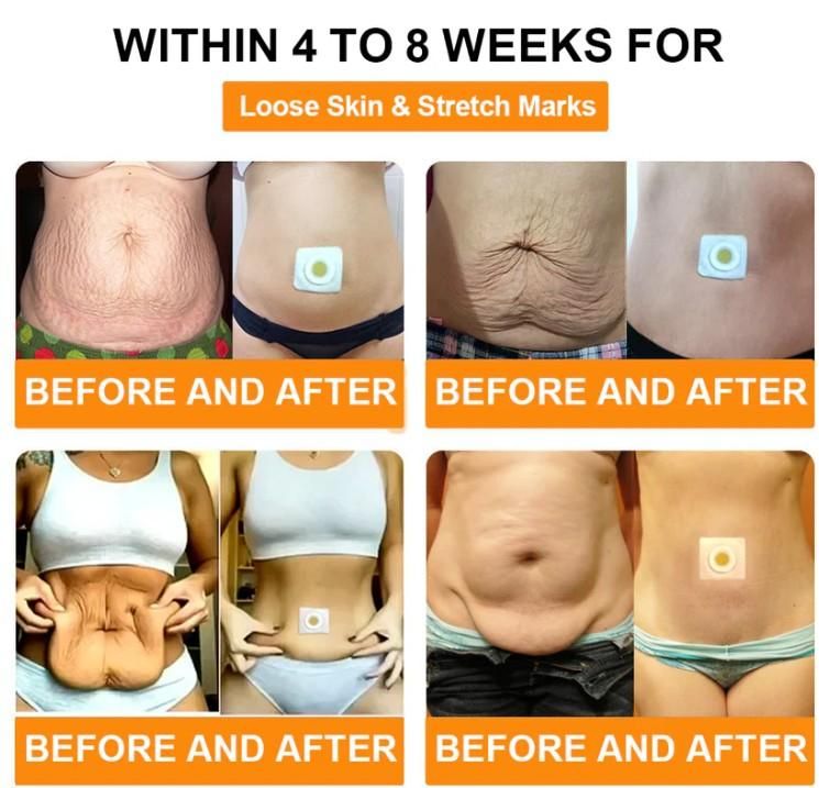 Bee Venom Slimming Patches (Pack of 10) Gym & Wellness